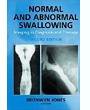 Normal and Abnormal Swallowing: Imaging in Diagnosis and Therapy