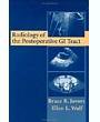 Radiology of the Postoperative GI Tract