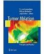 Tumor Ablation: Principles and Practice