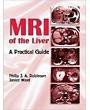 MRI of the Liver