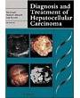 Diagnosis and Treatment of Hepatocellular Carcinoma (Greenwich Medical Media)