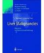 Liver Malignancies: Diagnostic and Interventional Radiology (Medical Radiology, Diagnostic Imaging and Radiation Oncology)